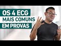 4 ECG mais comum PROVAS de CONCURSOS e RESIDÊNCIAS