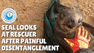 Seal Looks at His Rescuer After Painful Disentanglement