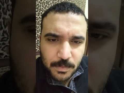 تحدي النظر بدون عيونك ما ترمش       
