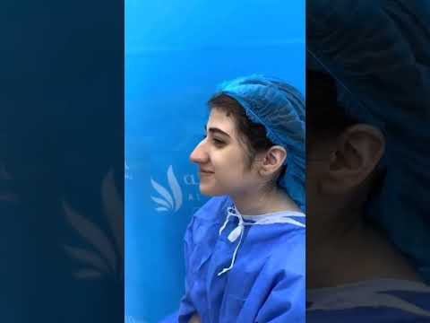 البروفيسور حسام ابو العطا جراح شد الوجه عمليات نحت الجسم تجميل الانف