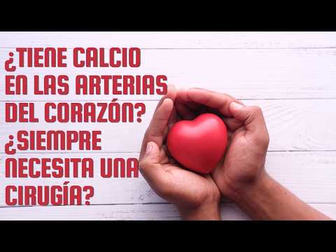 ¿Tiene calcio en las arterias del corazón? ¿Siempre necesita una cirugía? | Dr. Luis Felipe Felipe