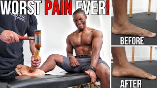 The WORST PAIN! | Fixing 29.1 YEARS Of Flat Feet w/ Trigger Point Massage