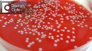 Is no growth of microorganism after 24hrs of aerobic incubation possible? - Dr. Sanjay Gupta