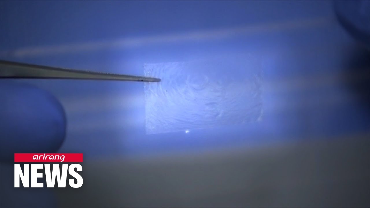 Triangular Nerve Block Patch S. Korean researchers develop patch that can easily connect severed ...