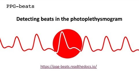 Detecting beats in the photoplethysmogram