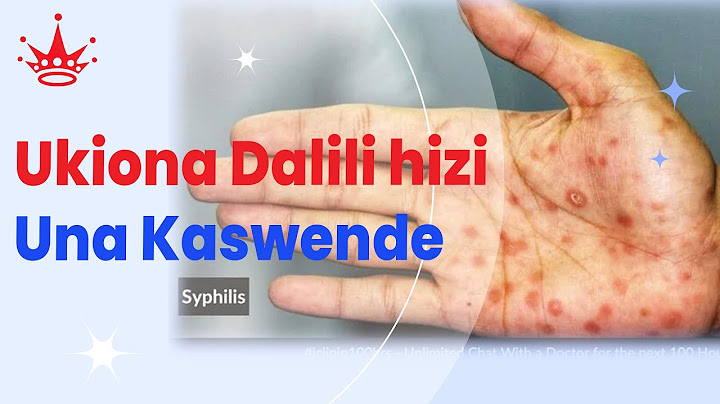 UJUE UGONJWA WA KASWENDE NA JINSI UNAVYOAMBUKIZWA || UKIONA DALILI HIZI UJUE UNA MAAMBUKIZI TAYARI