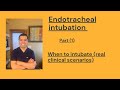 Endotracheal intubation part (1): When to intubate (real clinical scenarios)