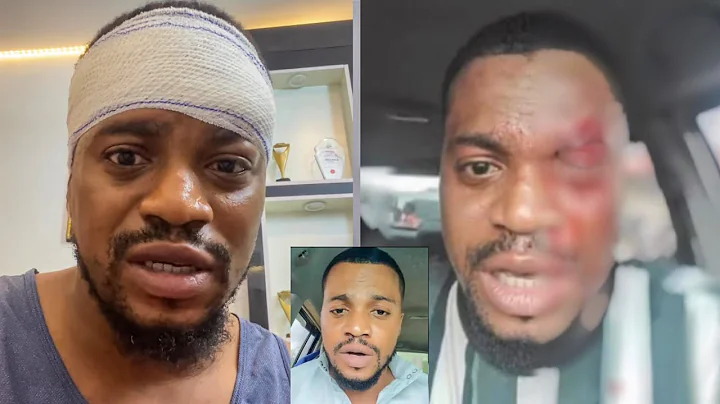 After He Was Bėaten By Area Boys, Actor Akeem Adeyemi Recounts His Hørrible Experience, Sheds More..