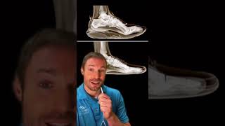 Mala característica de los zapatos (Nike & ADIDAS)