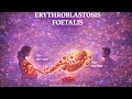 Erythroblastosis Foetalis