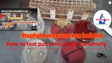 How to test  pus culture and sensitivity