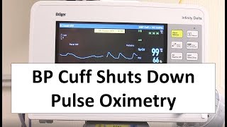 The Nefarious BP Cuff Shuts Down Pulse Oximetry
