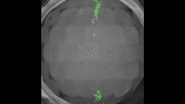 Scratch Assay: Kinetic analysis of in vitro wound closure by keratinocytes