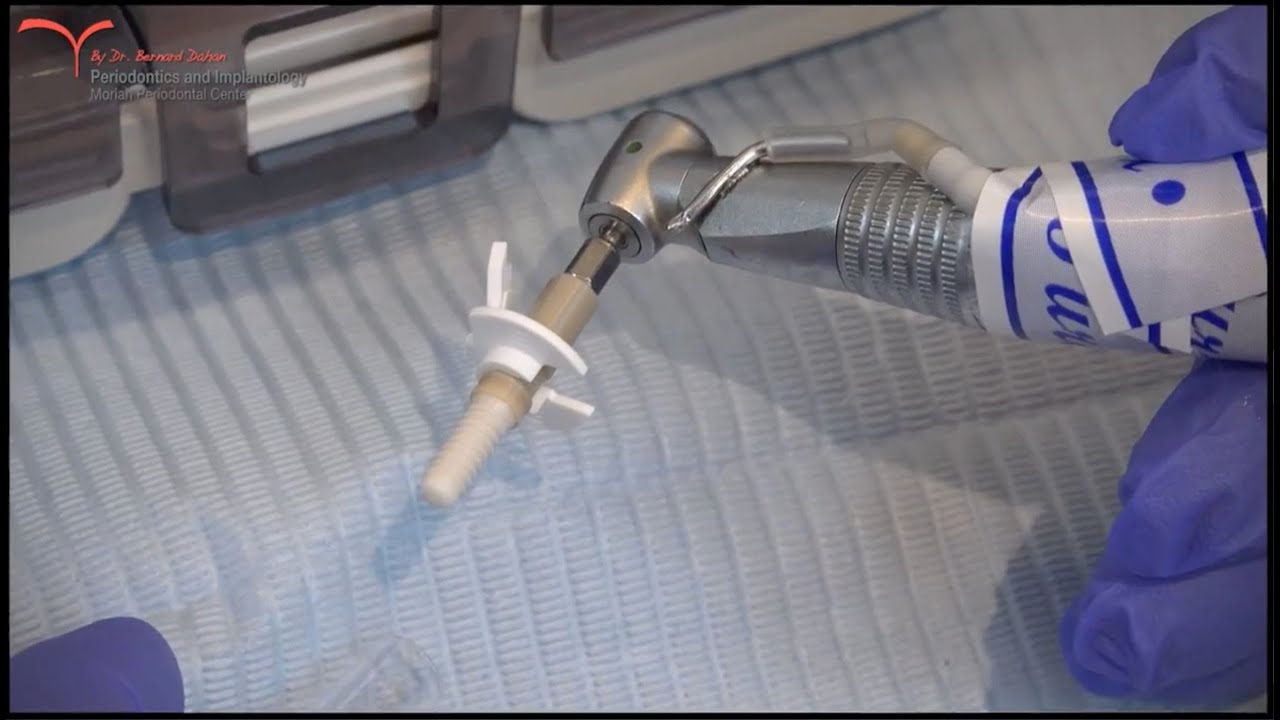 TAV Dental One Piece Zirconia Ceramic Implant Surgery by Dr Dahan YouTube