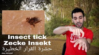 عملية ازالة حشرة القراد الخطيره في يديك Zecken،Tick ​​insect جديد New@alaaalkhalaff3202