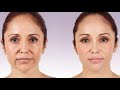 MASAJE PARA TONIFICAR EL ROSTRO - Lifting facial que elimina la flacidez