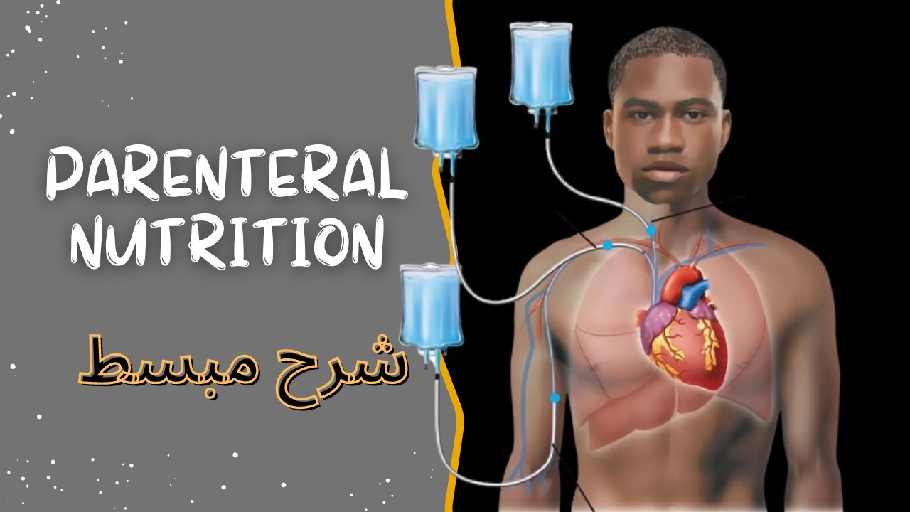 ممكن إنسان يعيش بدون الحاجه للأكل؟ شرح مبسط parenteral nutrition