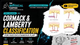 Cormack & Lamberty Classification of Fasciocutaneous Flaps | Types A, B, C & D