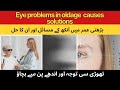Vision Problems نظر کے مسائل وجوہات اور علاج