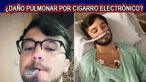 ¿Cuáles son los síntomas del pulmón de vapeador?