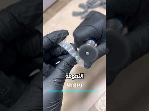 كيف يصنعون مثبت الأسنان المتحرك