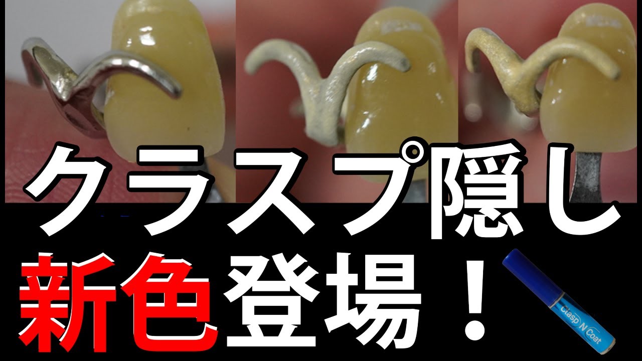 クラスプ隠し】塗って隠す！クラスプコート/ナチュラル - YouTube 