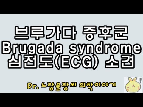 브루가다 증후군(Brugada syndrome) 심전도(ecg) 소견