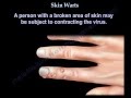 Skin Warts , Hand warts - Everything You Need To Know - Dr. Nabil Ebraheim