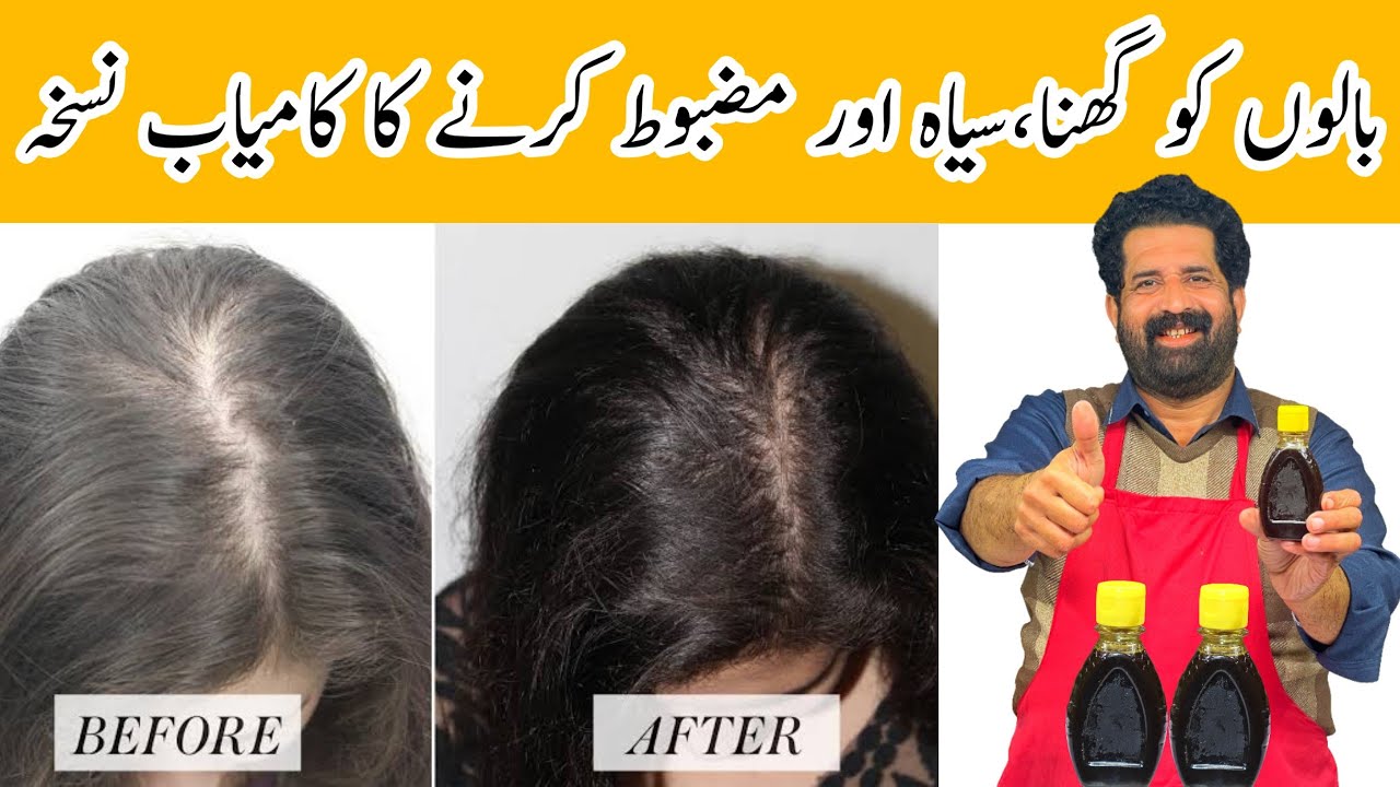 Homemade Hair Oli For Black Hair | بال لمبے موٹے اور کالے کرنے کا طریقہ| Magical Oil | BaBa Food RRC