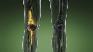 Regenerative medicine: Using your own body to heal itself