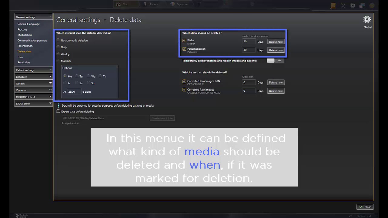 Effortless Data Management: Mastering Deletion Routines in Sidexis