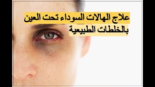 علاج الهالات السوداء تحت العين بالخلطات الطبيعية