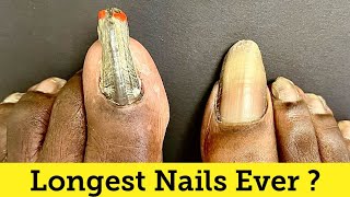 SUPER SATISFYING CUTTING OF VERY LONG TOENAILS !!!