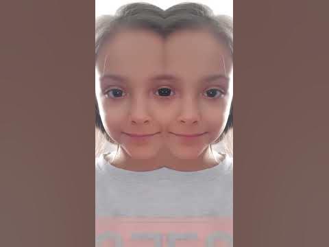 ета болезнь 😨 - YouTube