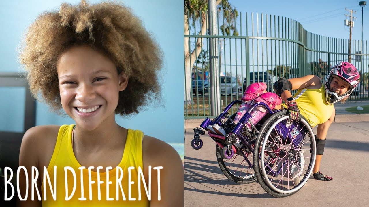 Spina Bifida Won’t Hold This 12-Year-Old Back | BORN DIFFERENT