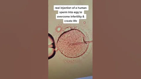 Real injection of sperm into a human egg to create a new life - DayDayNews