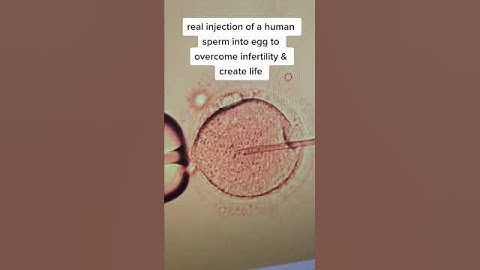 Real injection of sperm into a human egg to create a new life
