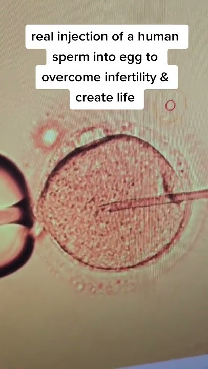 Real injection of sperm into a human egg to create a new life