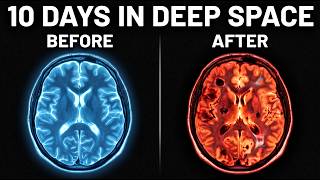 What 10 Days in Deep Space Did to the Artemis II Crew (Irreversible Damage)