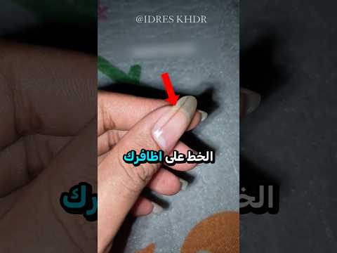 لا تتجاهل هذه العلامة على اظافرك أبدا