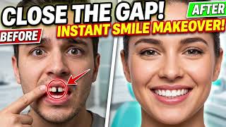 Exclusive 🦷 Front Teeth Gap? Here's the Smile Makeover Everyone's Talking About! Tooth Talkies Information