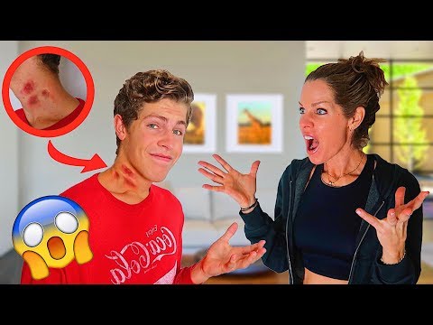 hickey-prank-on-mom!-(bad-idea)