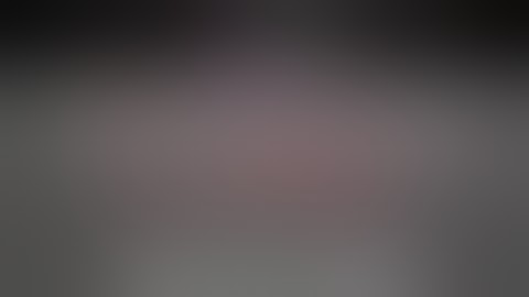 NIRF imaging with ICG for super-selective arterial clamping in pure laparoscopic partial nephrectomy