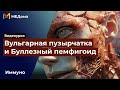 Вульгарная пузырчатка и Буллезный дерматит: ПРИЧИНЫ, ПАТОГЕНЕЗ и СИМПТОМЫ / USMLE step 1