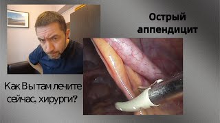 Острый аппендицит. Как Вы там лечите сейчас, хирурги?