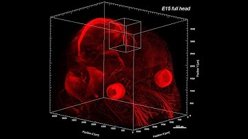 iDISCO - 3D of NECAB2 expression in Mouse brain - Hippocampus - Light sheet microscopy - Imaris