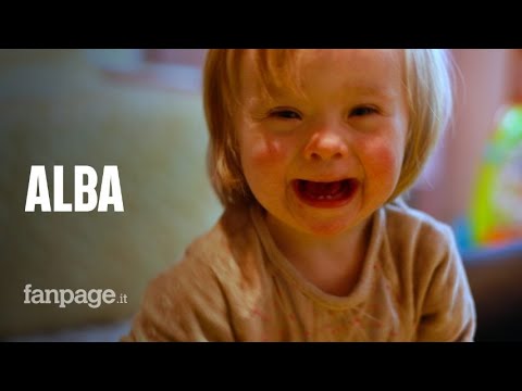 La nuova vita di Alba, la bimba down adottata dal papà single e gay: "La società non ci aiuta"