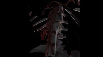 Orthopedic/ vascular segmentation volumetric rendering using Blender #blender #animation #blender3d