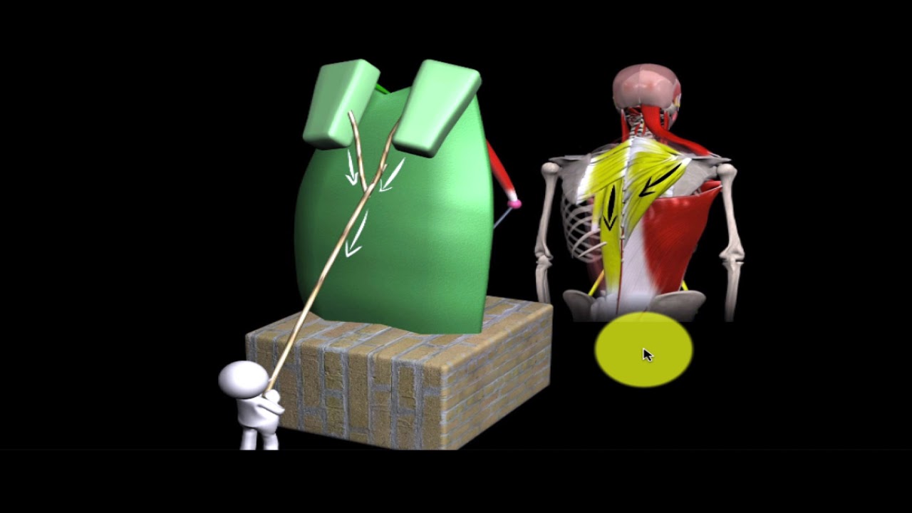 Kyfose - functioneel probleem (nekpijn - hoofdpijnklachten)