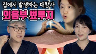 절대 집에서 혼자 짜지 마세요!! 💀💀💀 (feat.악순환의 반복) | 여성건강 채널No.1_우리동네 산부인과